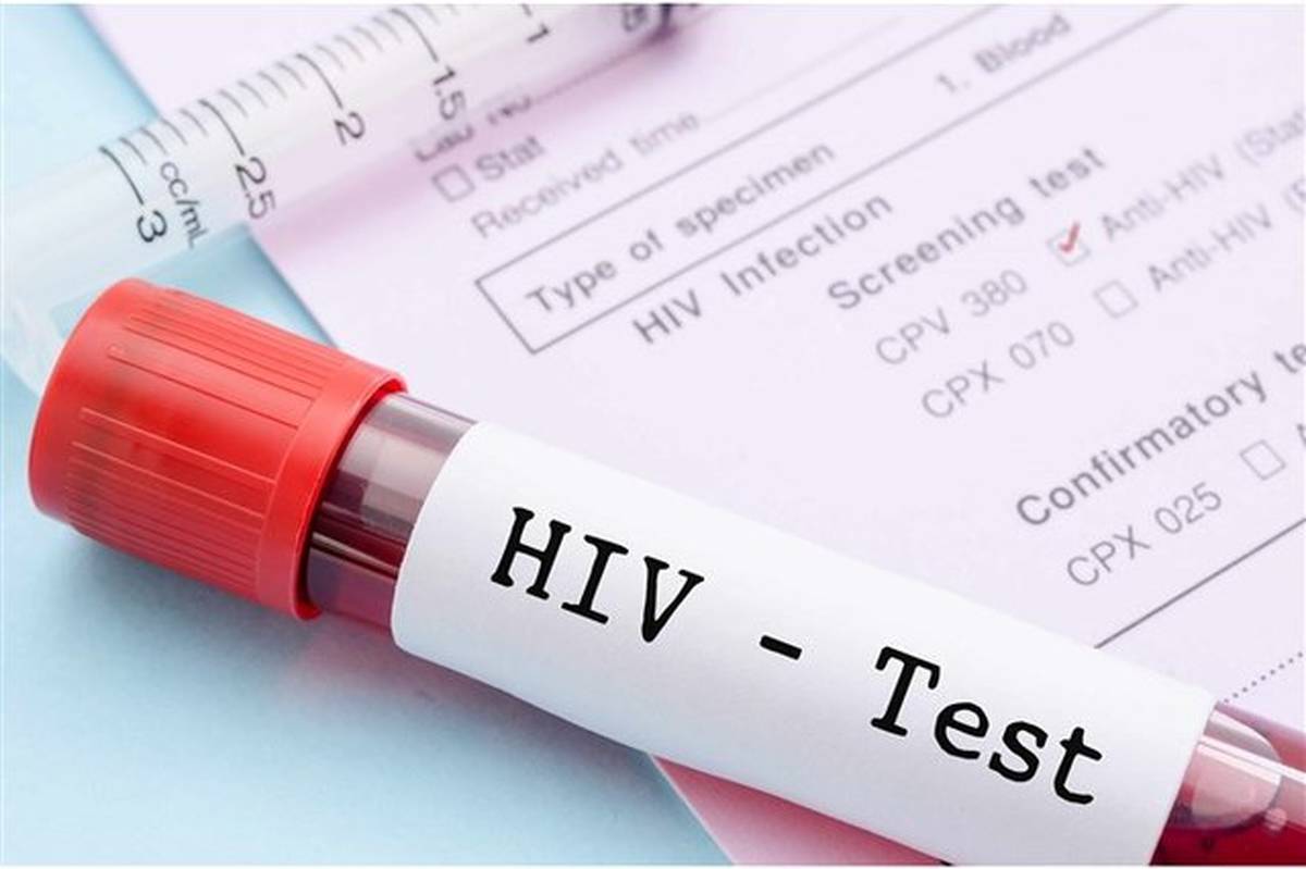۹۴ درصد بیماران HIV در ایران با درمان منظم دیگر ناقل ویروس نیستند