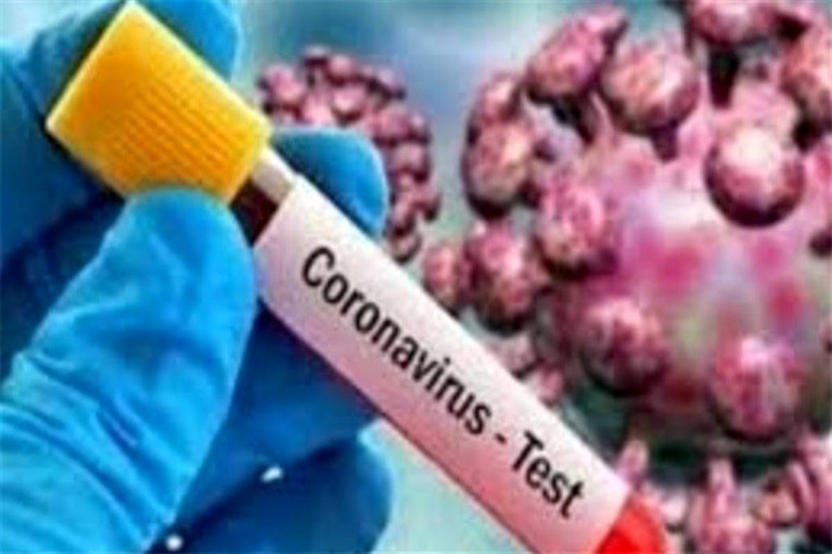  دانشگاه علوم پزشکی اهواز:شناسایی ۱۸۶ مورد جدید مبتلا به کرونا ویروس در طول شبانه روز  گذشته در خوزستان