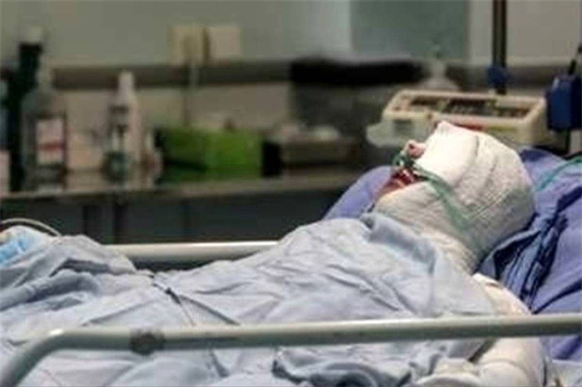 بیمار سوختگی مبتلا به کرونا در شیراز بهبود یافت