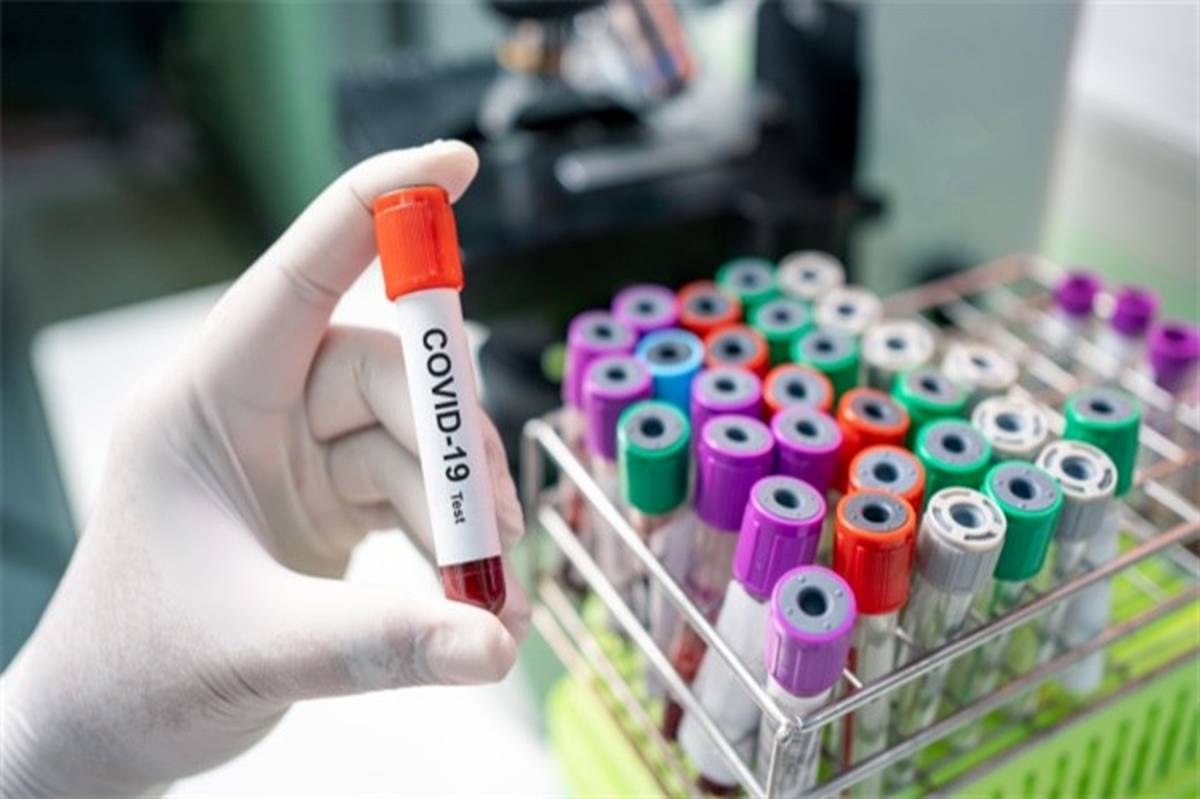 واکسن کرونا از ۲۵ مرداد در دسترس مردم روسیه قرار می‌گیرد