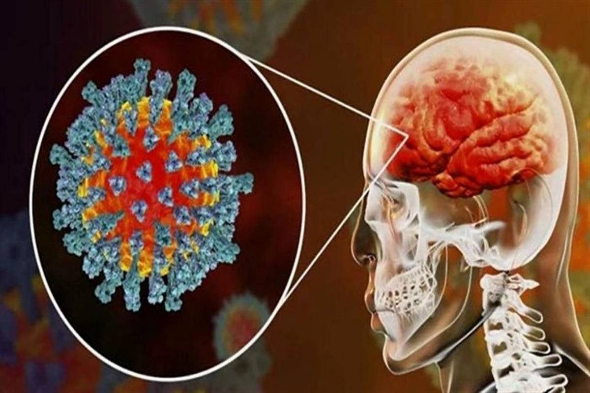 اثرات ویروس کرونا بر مغز چیست ؟