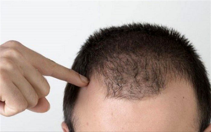 7 نشانه درباره سلامتی که موها به ما تذکر می‌دهند