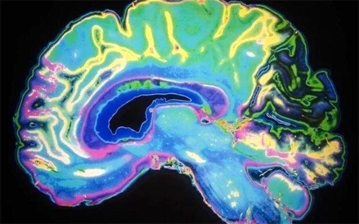 اختلال عملکردهای مهم مغز با نرم‌کننده‌ها