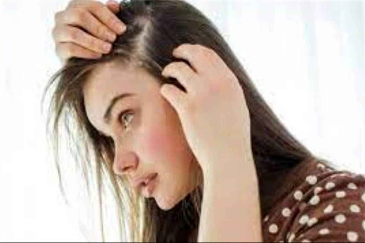 ریزش مو در نوجوانی را جدی بگیرید