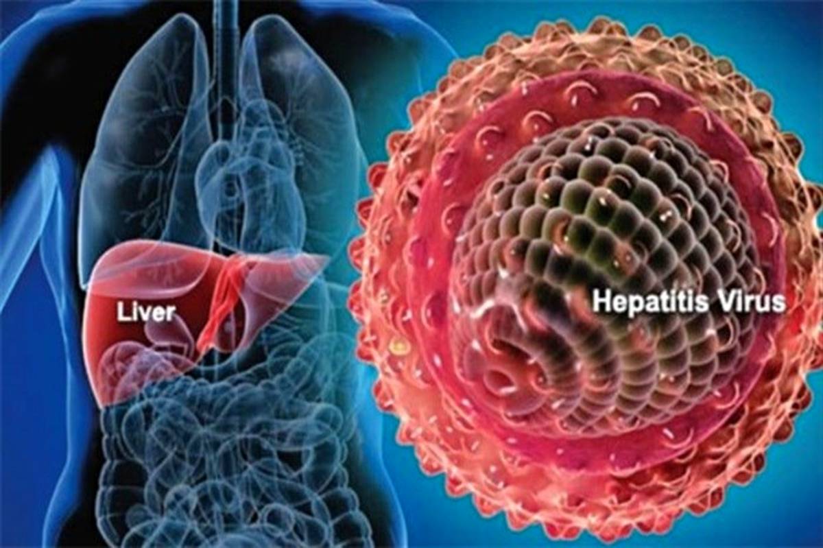 درباره هپاتیت دلتا بیشتر بدانید