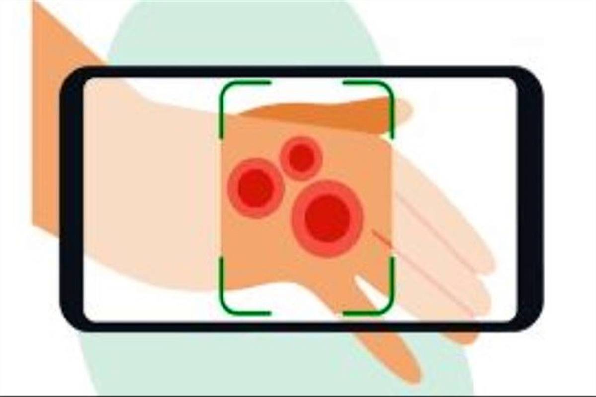 طراحی برنامه‌ای برای تشخیص و درمان بیماری‌های پوستی