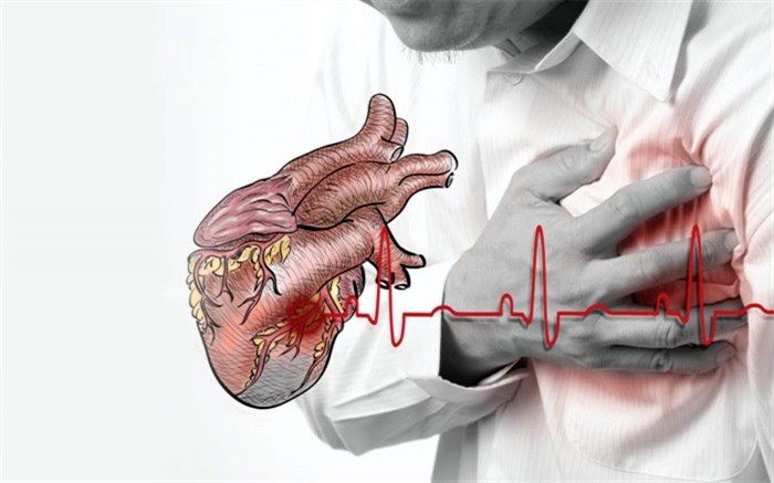 علایم سکته قلبی یک ماه قبل از وقوع