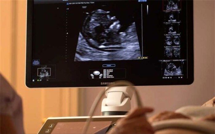سونوگرافی برای جنین مضر است؟