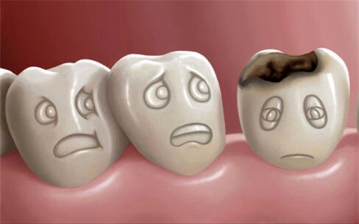 پنج عادتی که دندان‌ها را خراب می‌کند