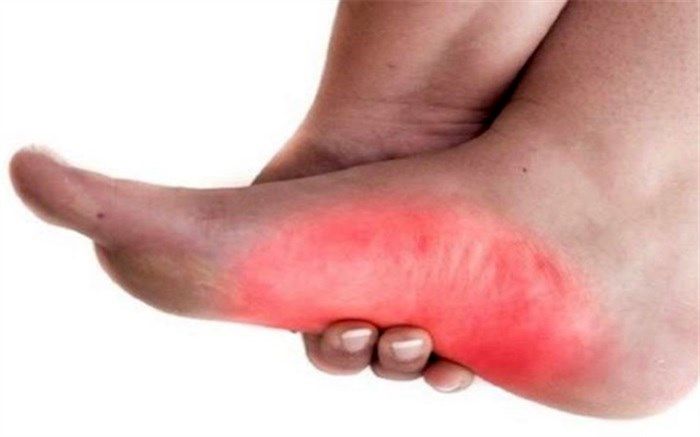 علت درد ماهیچه پا در شب چیست؟