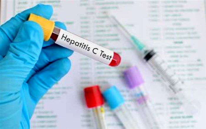 هپاتیت سی در ۳ گروه‌ پرخطر ریشه‌کن خواهد شد
