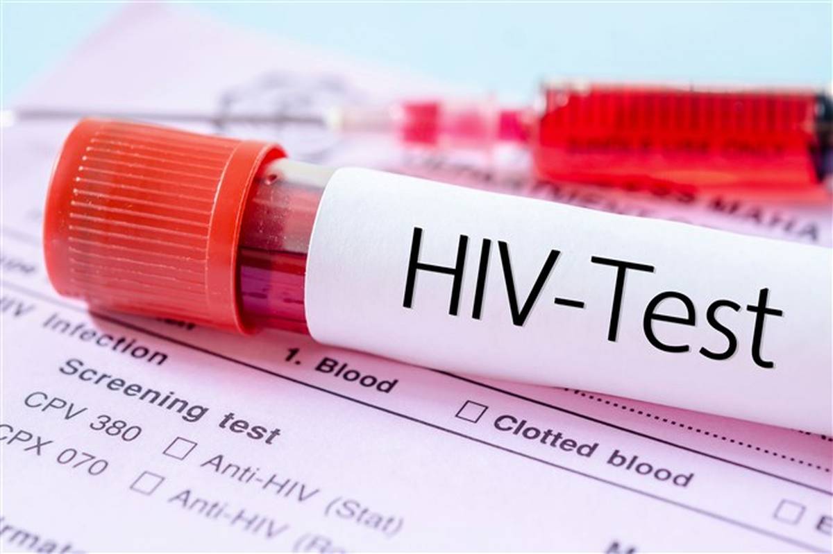 آخرین آمارها از بیماری HIV در کشور