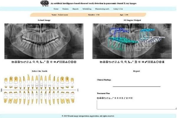 توسعه سامانه هوشمند تحلیل تصاویر دندانپزشکی در دانشگاه تهران