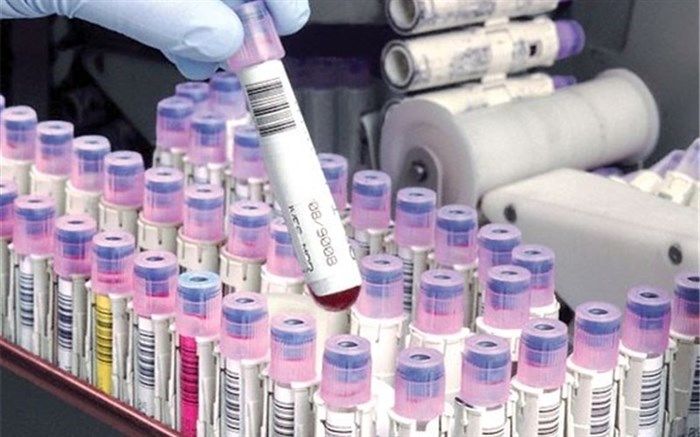 ۸۰۰ نمونه از استان اردبیل در بانک خصوصی خون بند ناف رویان ذخیره‌سازی شد