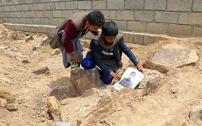 مرگ ۸۵ هزار کودک یمنی بر اثر بیماری و گرسنگی مفرط