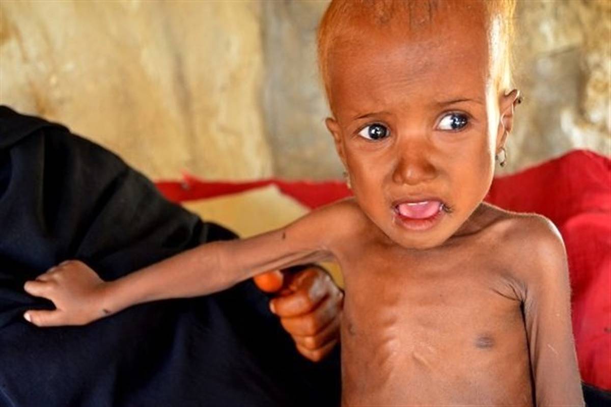 یونیسف: روزانه ۸ کودک یمنی کشته و یا زخمی می‌شوند