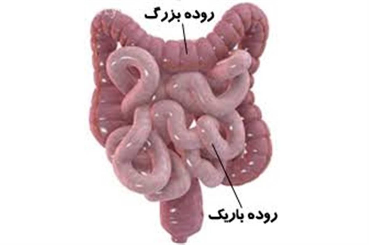 افزایش سرطان روده در گیلان