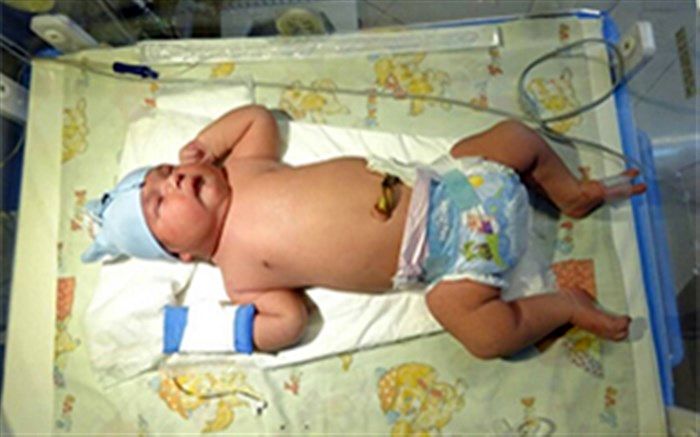 نوزادی با ۶.۴ کیلوگرم وزن در میاندوآب متولد شد