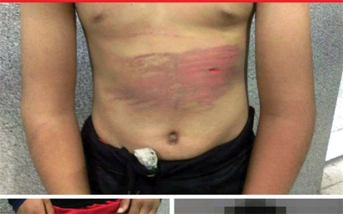 کباب خوری نوجوان 12 ساله با ضرب و شتم پدرش همراه شد