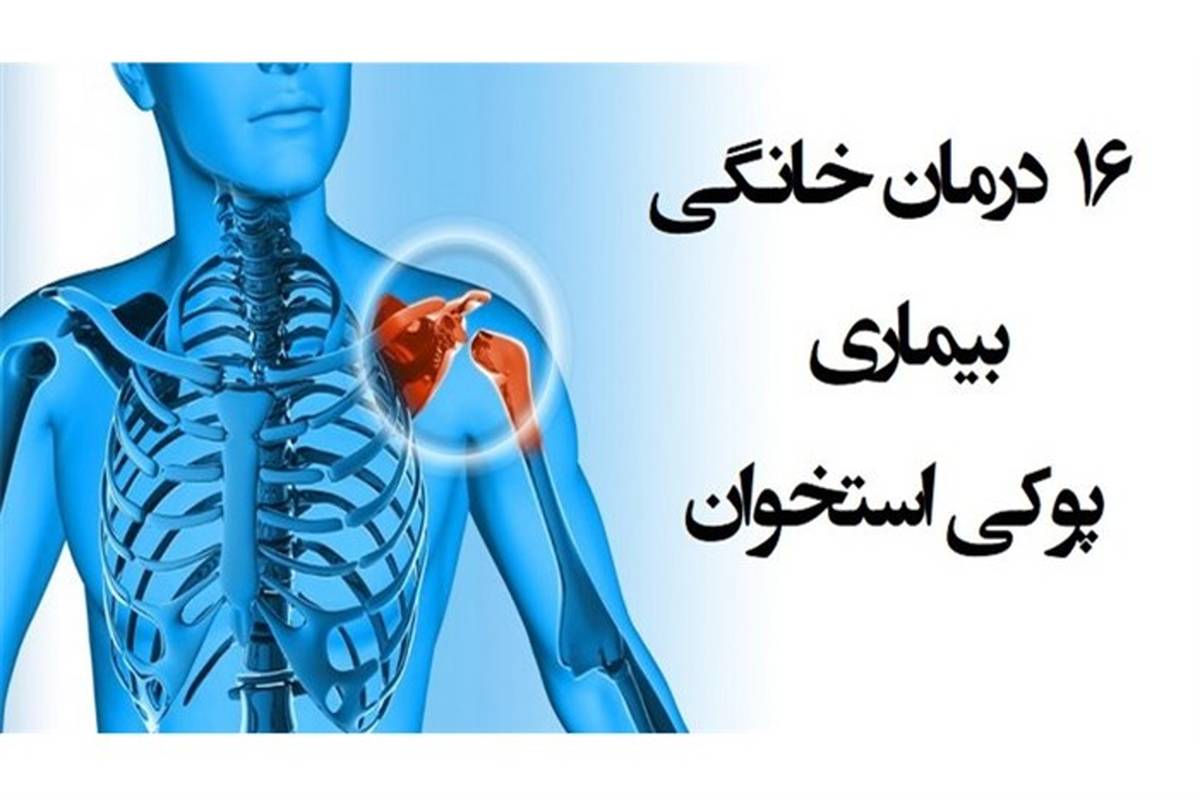 هشدار؛ سونامی پوکی استخوان در راه است