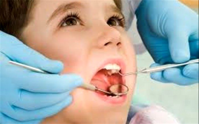 سلامت دندان‌های کودکان را جدی بگیرید!