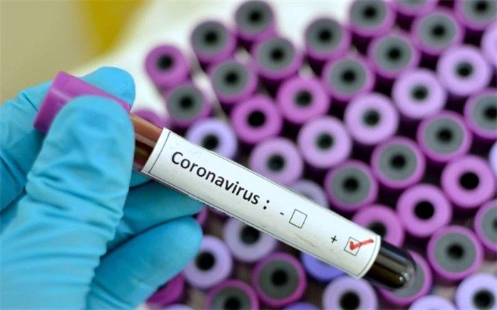 هیچگونه علائمی از وجود ویروس کرونا در یزد مشاهده نشده است