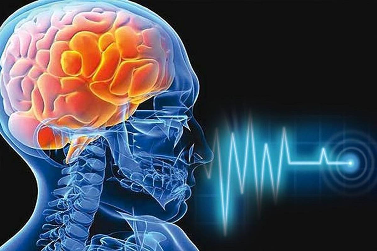 چه عواملی باعث ابتلا به «سکته مغزی» می‌شوند؟
