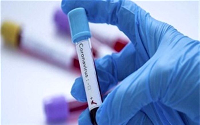 آزمایش دو بیمار مشکوک به کرونا ویروس در اردبیل منفی است