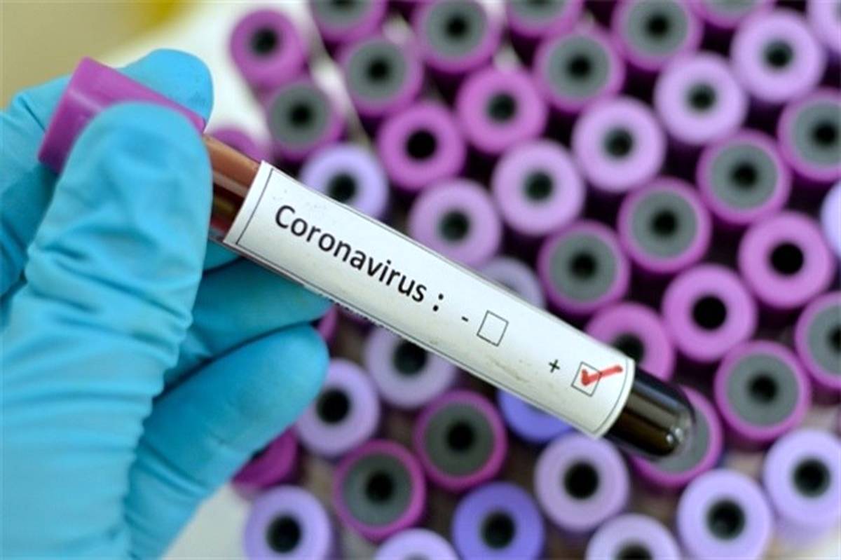 آمار مبتلایان ویروس کرونا در منطقه کاشان به ۴۶۹ مورد افزایش یافت