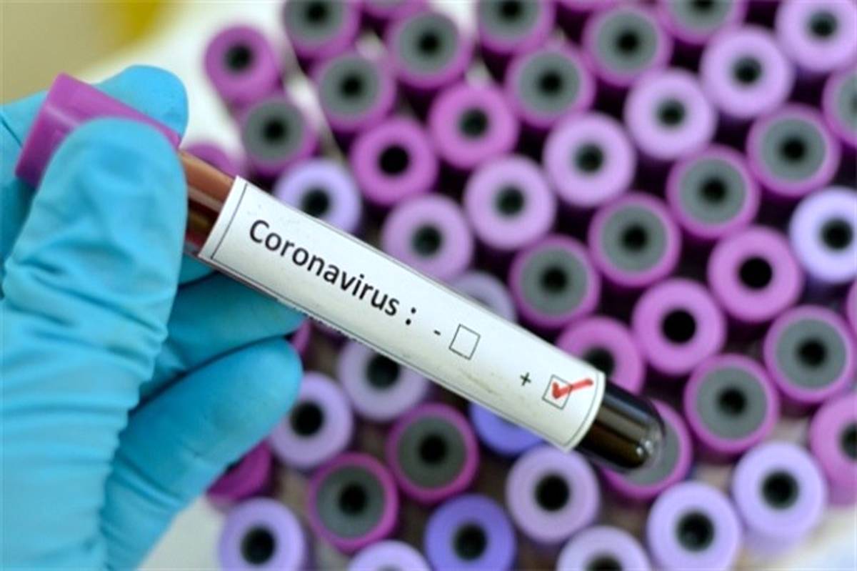  شناسایی ٢٥ مورد جدید ابتلا به کرونا ویروس طی شبانه روز گذشته در استان خوزستان