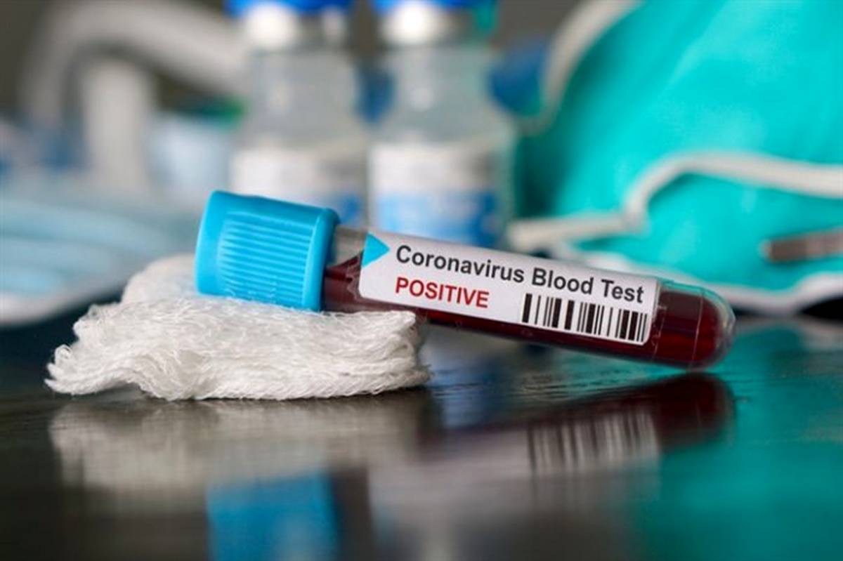 شناسایی ۳۹ مورد جدید ابتلا به کروناویروس  طی شبانه  روز گذشته در خوزستان