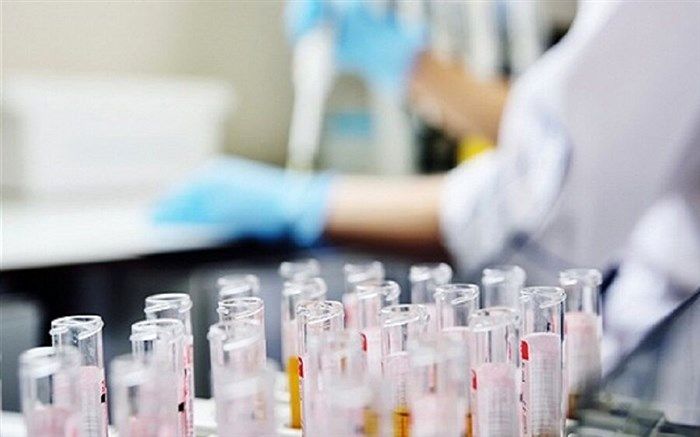 رییس دانشگاه علوم پزشکی شیراز: روزانه بیش از هزار و دویست آزمایش کووید۱۹ در آزمایشگاه های فارس انجام می‌شود