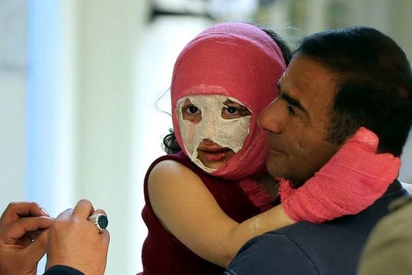 چهارشنبه‌سوری سنتی زیباست اما بی‌احتیاطی آن را به فاجعه تبدیل می‌کند