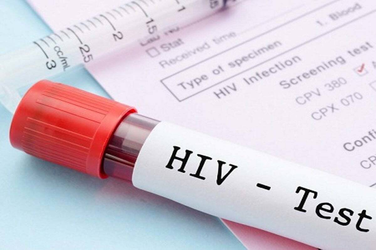 در پویش"من هم تست HIV می‌دهم " به دنبال اطلاع‌رسانی همگانی هستیم