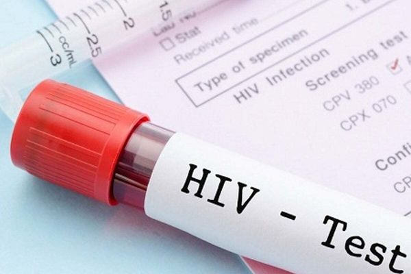 در پویش"من هم تست HIV می‌دهم " به دنبال اطلاع‌رسانی همگانی هستیم