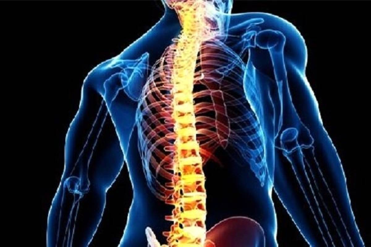 افزایش درد و مشکلات ستون فقرات در نسل جوان 