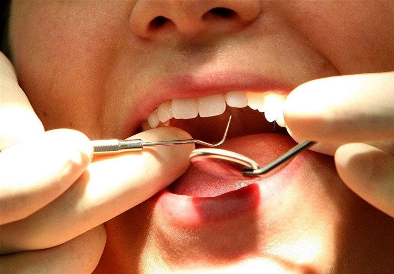 سلامت دهان و دندان روی سلامت عمومی افراد اثر می‌گذارد